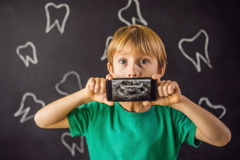 Pediatric xrays - A boy in a green shirt holds a phone displaying a dental X-ray in front of his mouth, with chalk-drawn teeth on a blackboard behind him—an imaginative scene that captures the playful spirit at Chestnut Dental Needham.