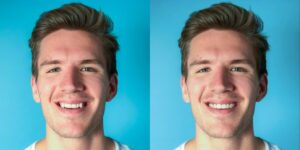 Side-by-side photos of a young man with light brown hair smiling, set against a blue background—perfect for showcasing patient transformations at Chestnut Dental Needham or Bedford.