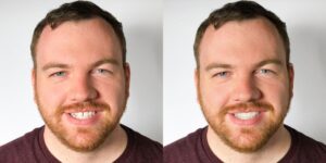 Side-by-side photos of the same man with short brown hair and a beard, wearing a maroon shirt, smiling at the camera against a plain white background at Chestnut Dental Needham.