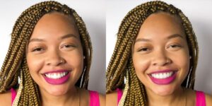Side-by-side photos of a smiling woman with braided hair, wearing a pink top and bright pink lipstick, against a plain white background at Chestnut Dental Needham.