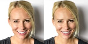Side-by-side photos of a smiling woman with blonde hair, wearing a grey shirt, facing forward against a plain white background at Chestnut Dental Needham.